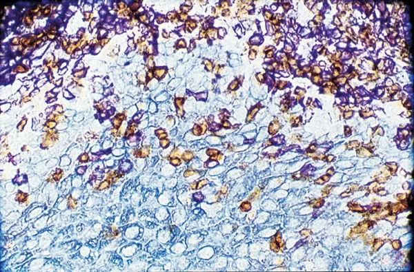Dab Substrate Kit, Peroxidase (Hrp), With Nickel, (3,3'-Diaminobenzidine)