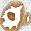 Prostate: Prostate Specific Antigen (p), ImmPRESS Anti-Goat Ig Kit, ImmPACT DAB (brown), substrate. Hematoxylin QS counterstain.
