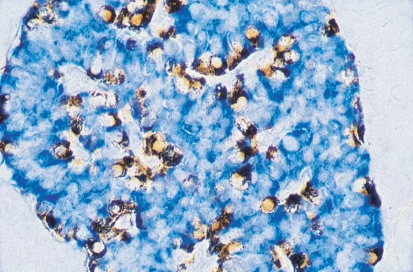 Pancreas (Double Label): Beta Cells (Blue, Vector Blue), Alpha Cells (Brown, Vector Dab).