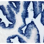 Prostate: Psa (M), Vectastain Abc-Ap Mouse Igg Kit, Bcip/Nbt (Indigo), Viewed Under Bright Field Microscopy.