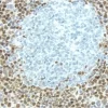 Lymph Node: Cyclin D1 (rm), ImmPRESS Anti-Rabbit Ig Kit, DAB (brown) substrate. Hematoxylin QS (blue) counterstain.
