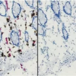 Endogenous Alkaline Phosphatase (Ap) And Peroxidase (Hrp) Activities In Frozen Intestine Revealed With Vector Red Ap Substrate (Red) And Immpact Dab Hrp Substrate (Brown) (Left). Same Substrates Used On Bloxall Solution-Treated Tissue (Right). Bloxall B