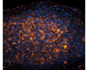 Tonsil (FFPE): Antigen Retrieved with Antigen Unmasking Solution and stained with Cy3 PNA (red-orange). Mounted in VECTASHIELD HardSet with DAPI (blue).