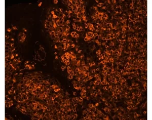 Tonsil (FFPE): Antigen retrieved with Antigen Unmasking Solution and stained with Cy3 SNA (red-orange). Mounted in VECTASHIELD HardSet Mounting Medium.