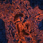 Tonsil (Ffpe) Was Antigen Retrieved With Antigen Unmasking Solution, And Stained With Anti-Pan Cytokeratin Mouse Primary Antibody (Clone Ae1/Ae3), B-Horse X Mouse Igg And Cy3-Streptavidin. Mounted In Vectashield Hardset Mounting Medium With Dapi.