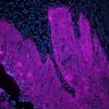 Tonsil (FFPE) was antigen retrieved with Antigen Unmasking Solution, and stained with Anti-Pan Cytokeratin mouse primary antibody (clone AE1/AE3), B-Horse x Mouse IgG, and Cy5-Streptavidin.