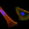 Mouse embryonal fibroblasts: Anti-Cytokeratin (m) detected with DyLight 488 Anti-Mouse IgG, mounted in a 1:1 mixture of VECTASHIELD HardSet Mounting Medium with DAPI and VECTASHIELD HardSet Mounting Medium with TRITC-Phalloidin.