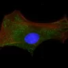 Mouse embryonal fibroblasts: Anti-Cytokeratin (m) detected with DyLight 488 Anti-Mouse IgG, mounted in a 1:1 mixture of VECTASHIELD HardSet Mounting Medium with DAPI and VECTASHIELD HardSet Mounting Medium with TRITC-Phalloidin.