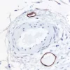 Colon submucosa: Lymphatic endothelium stained using mouse monoclonal antibody against M2A antigen (clone D2-40; Cat. No. VP-M671), ImmPress anti-mouse Ig reagent (MP-7402), and Vector NovaRED peroxidase substrate (SK-4800; red). Hematoxylin QS countersta