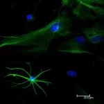 Astrocytes: Stained For Gfap And Detected With Dylight 488 Labeled Secondary Antibody. Mounted In Vectashield Hardset Mounting Medium With Dapi. Image Courtesy Of Dr Emma East, Department Of Life Sciences, The Open University, U.k.*