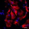 Astrocytes: Stained for GFAP and detected with Dylight 594 labeled secondary antibody. Mounted in VECTASHIELD HardSet Mounting Medium with DAPI. Image courtesy of Dr Emma East, Department of Life Sciences, The Open University, U.K.*