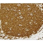 Vectastain® Elite® Abc Universal Plus Kit, Peroxidase (Horse Anti-Mouse/Rabbit Igg)