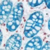Colon (double label): Anti-AE1/AE3 (mouse monoclonal, Cat. No. VP-C419), ImmPRESS-AP anti-mouse Ig reagent, Vector Blue (blue). Anti-CD3 (rabbit monoclonal, Cat. No. VP-RM01), ImmPRESS (Peroxidase) Anti-Rabbit Ig, ImmPACT AMEC Red (red).