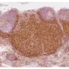 Rhesus macaque formalin/paraffin lymph node: CD4 (1F6), ImmPRESS Anti-Mouse Ig Kit, ImmPACT DAB substrate (brown). Hematoxylin counterstain (blue). Courtesy of Charles Brown, NIH, NIAID, Laboratory of Molecular Microbiology.