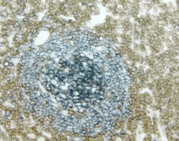 Tonsil (Double Label): Cd3 (M), Vectastain Universal Elite Abc Kit, Vector Dab Substrate (Brown); Cd20 (M), Vectastain Universal Elite Abc Kit, Vector Sg Substrate (Blue/Gray).