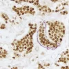 DAB Substrate Kit, Peroxidase (HRP), with Nickel, (3,3'-diaminobenzidine)