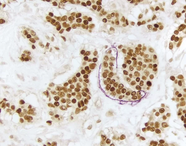 Dab Substrate Kit, Peroxidase (Hrp), With Nickel, (3,3'-Diaminobenzidine)