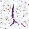 DAB Substrate Kit, Peroxidase (HRP), with Nickel, (3,3'-diaminobenzidine)