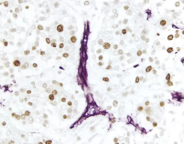 Dab Substrate Kit, Peroxidase (Hrp), With Nickel, (3,3'-Diaminobenzidine)