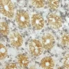 Small Bowel (double label): CD45 (m); VECTASTAIN Universal Elite ABC Kit, DAB+Ni substrate (gray/black); Epithelial Specific Antigen (m), VECTASTAIN Universal Elite ABC Kit, DAB substrate (brown).