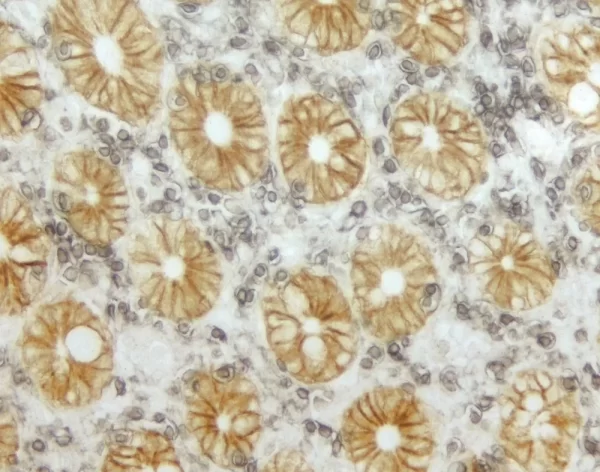 Small Bowel (Double Label): Cd45 (M); Vectastain Universal Elite Abc Kit, Dab+Ni Substrate (Gray/Black); Epithelial Specific Antigen (M), Vectastain Universal Elite Abc Kit, Dab Substrate (Brown).
