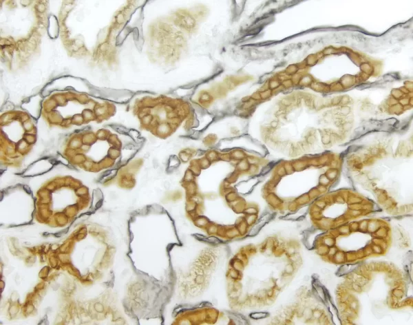 Kidney (Double Label): Cd34 (M), Vectastain Universal Elite Abc Kit, Dab + Ni Substrate (Gray/Black); Cytokeratin 8/18 (M), Vectastain Universal Elite Abc Kit, Dab.