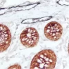 Colon (double label): M2A Antigen (m), ImmPRESS Universal Reagent, DAB+Ni substrate (gray/black); Cytokeratin 8/18 (m), ImmPRESS Universal Reagent, Vector NovaRED substrate (red).