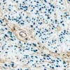 Endometrium (double label): Progesterone Receptor (rm), VECTASTAIN Universal ABC-AP Kit, Vector Blue substrate (blue); CD34 (m), VECTASTAIN Universal Elite ABC Kit, DAB substrate (brown).