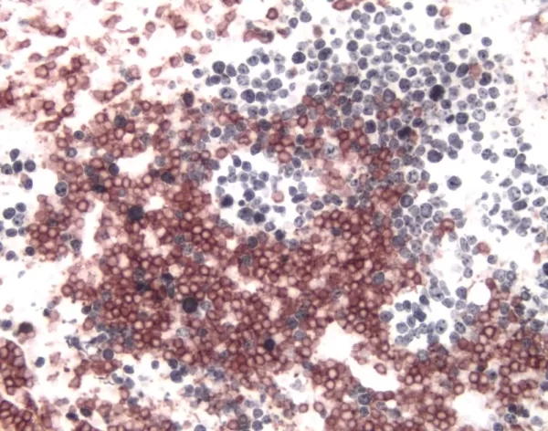 Tonsil (Double Label): Cd3 (M), Immpress Anti-Mouse Ig Reagent, Vector Novared Substrate (Red); Ki67 (M), Immpress Anti-Mouse Ig Reagent, Vector Dab+Ni Substrate (Gray/Black).