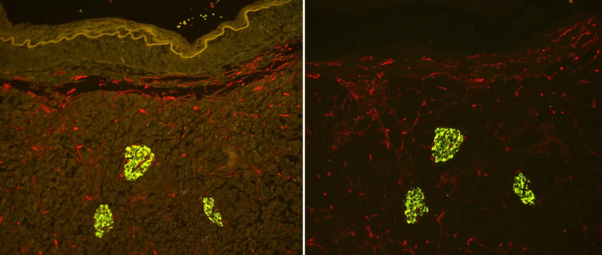 Pancreas1 Jpg