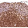 Rhesus macaque formalin/paraffin lymph node: CD4 (1F6), ImmPRESS Anti-Mouse Ig Kit, ImmPACT DAB substrate (brown). Hematoxylin counterstain (blue). Courtesy of Charles Brown, NIH, NIAID, Laboratory of Molecular Microbiology.