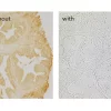 Prostate without and with R.T.U. Animal Free Block and Diluent used in the blocking step. Both sections are no primary antibody controls with Biotinylated Universal Secondary Antibody
