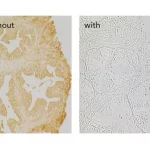 Prostate Without And With R.t.u. Animal Free Block And Diluent Used In The Blocking Step. Both Sections Are No Primary Antibody Controls With Biotinylated Universal Secondary Antibody