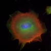 Mouse embryonal fibroblasts: Anti-Cytokeratin (m) detected with DyLight 488 Anti-Mouse IgG, mounted in a 1:1 mixture of VECTASHIELD HardSet Mounting Medium with DAPI and VECTASHIELD HardSet Mounting Medium with TRITC-Phalloidin.