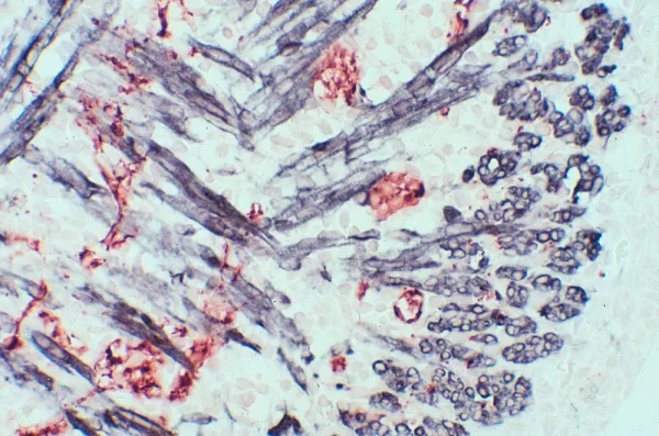 Mouse, Newborn (Tongue, Double Label): Synapsin (M), Mom Peroxidase Kit, Vector Novared Substrate (Red); Desmin (M), Mom Peroxidase Kit, Dab+Ni Substrate (Gray/Black).