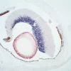 Mouse, Newborn (eye, double label): GFAP (m), MOM Peroxidase Kit, Vector NovaRED substrate (red); Synapsin (m), MOM Peroxidase Kit, DAB+Ni substrate (gray/black). Note contrast with endogenous pigment (brown) seen in surrounding tissues.