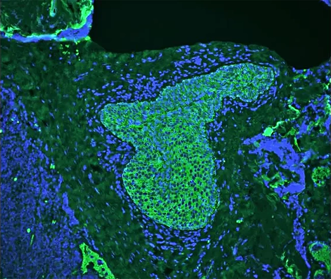 Br Autofluorescence Quencher Pic1