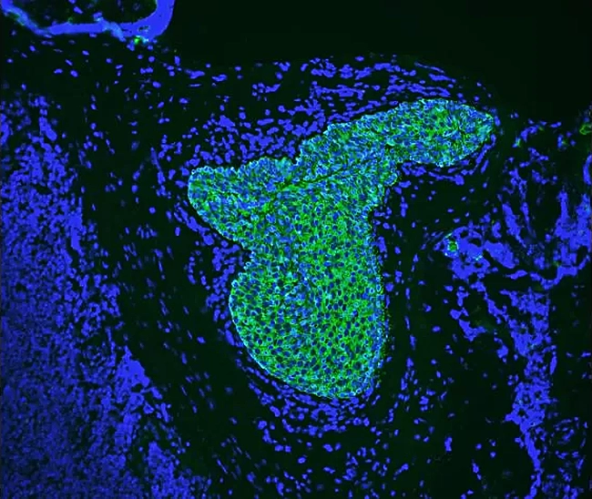 Br Autofluorescence Quencher Pic2