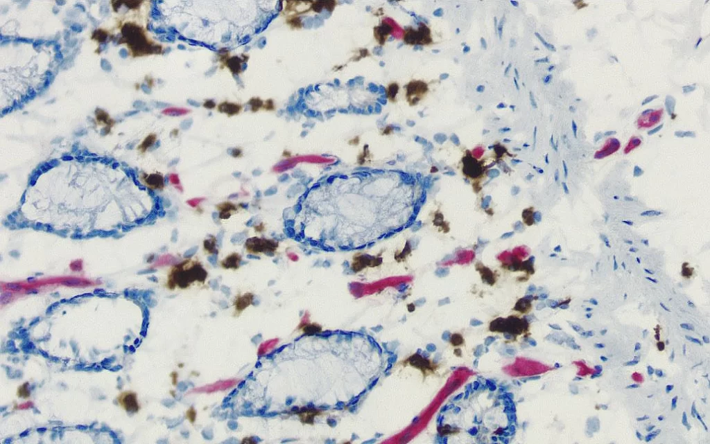 Br Endogenous Enzyme Pic1