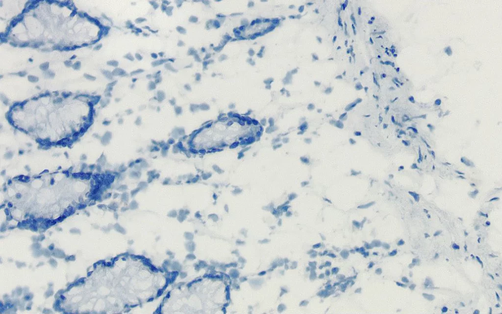 Br Endogenous Enzyme Pic2