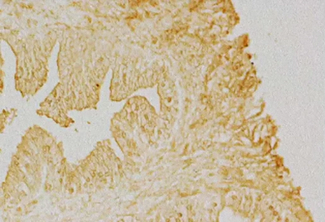 Br Protein Blocking Reagents Pic1