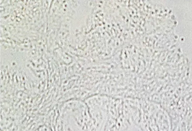 Br Protein Blocking Reagents Pic2