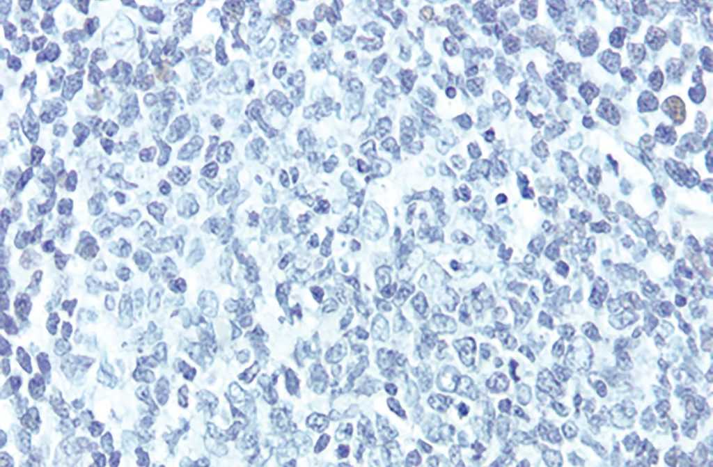 Antigen Retrieval Figure1A
