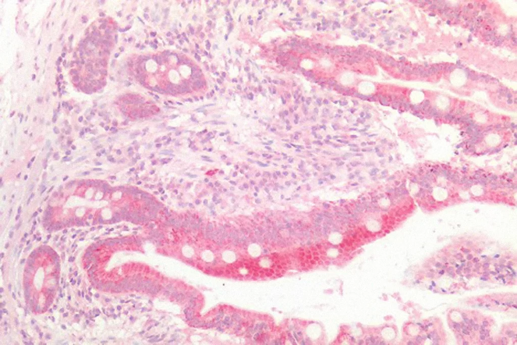 Cancer Ihc Plus Antibody