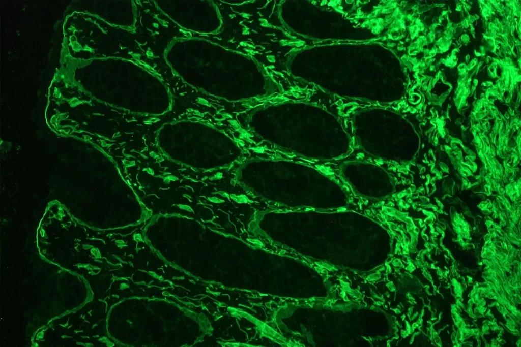 Cancer Anti Laminin Rat Antibody