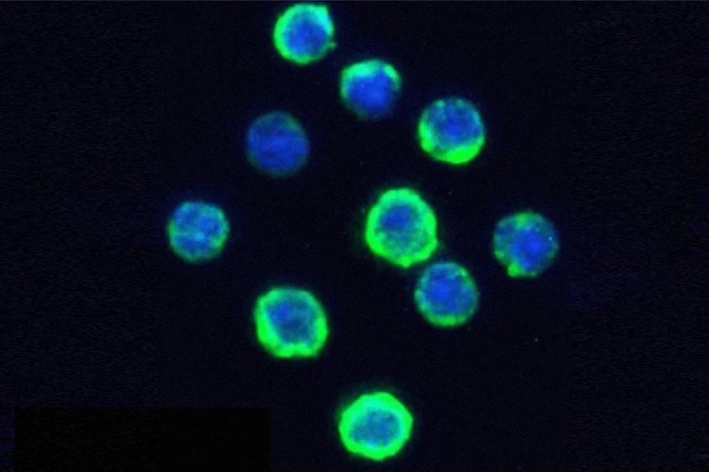 Cancer Recombinant Anti Cd20