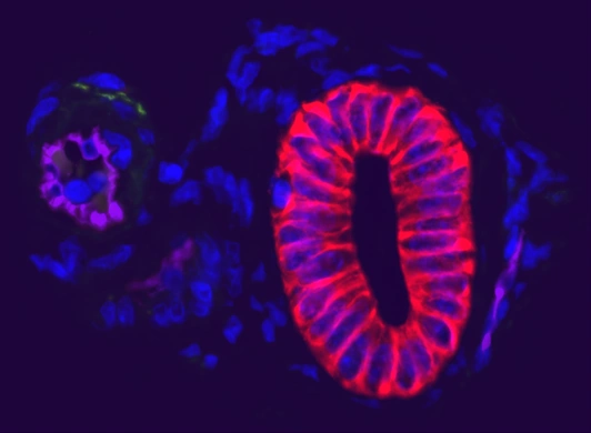 If Autofluorescence 1