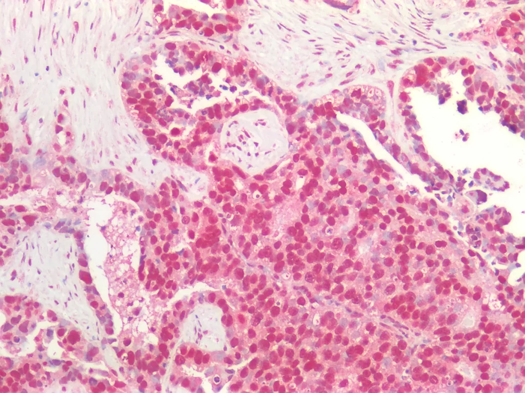 Primary Antibodies Pic3