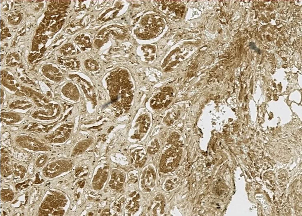 Sos Hoh Kidney Pic1