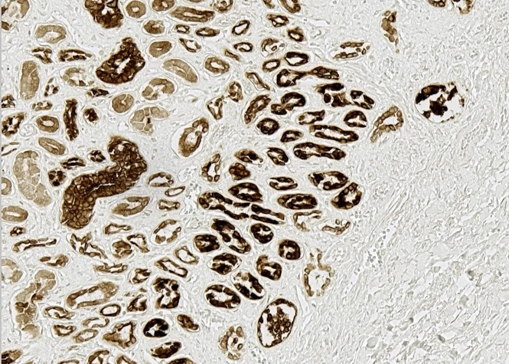 Sos Hoh Kidney Pic2